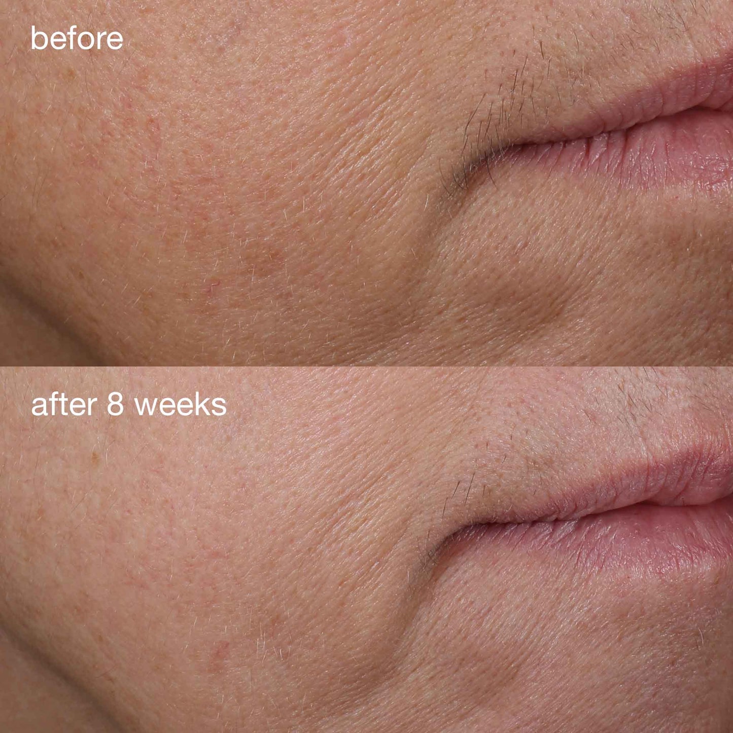 Dermalogica Age Smart Phyto-Nature Firming Serum before and after 8 weeks of use