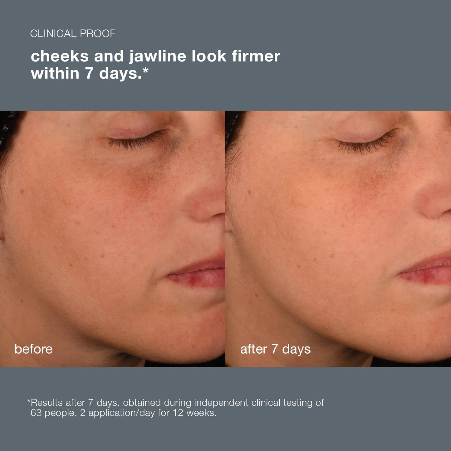 Dermalogica Pro-Collagen Banking Serum