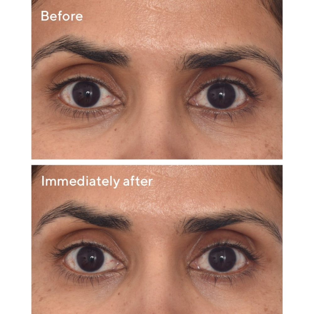 before and immediately after use results