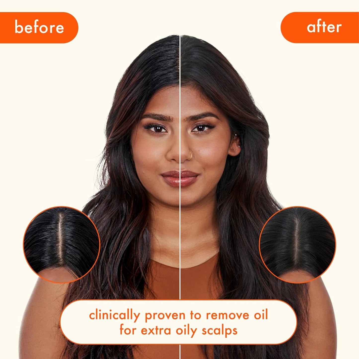 before and after showing less oily hair and scalp. clinically proven to remove oil for extra oily scalps.