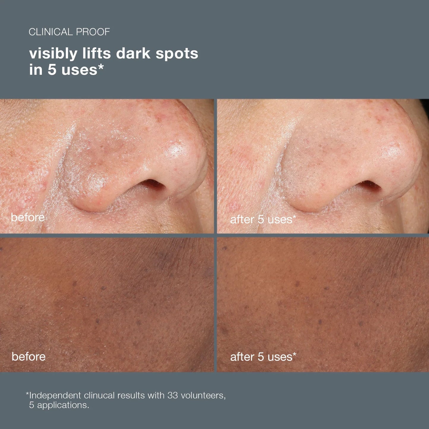 Dermalogica PowerBright Dark Spot Peel