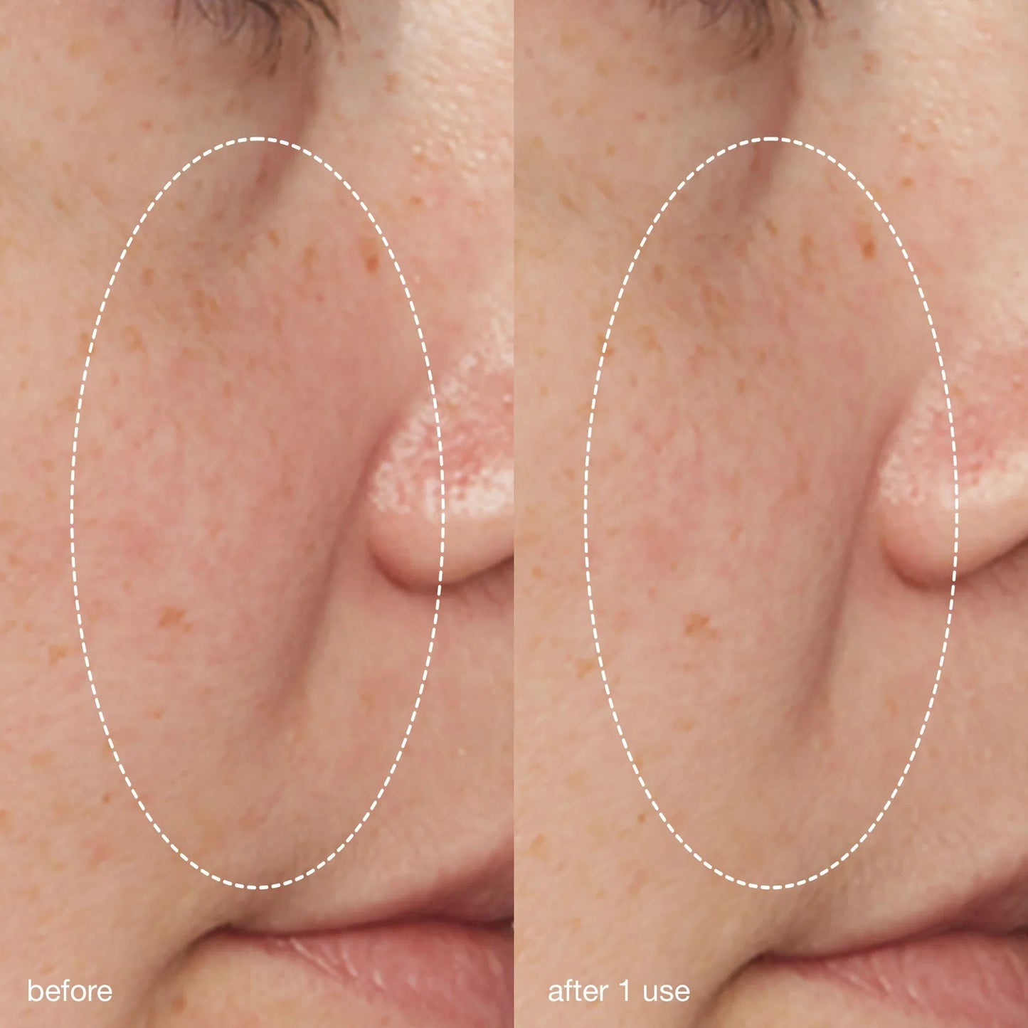 Dermalogica Liquid Peelfoliant before and after 1 use