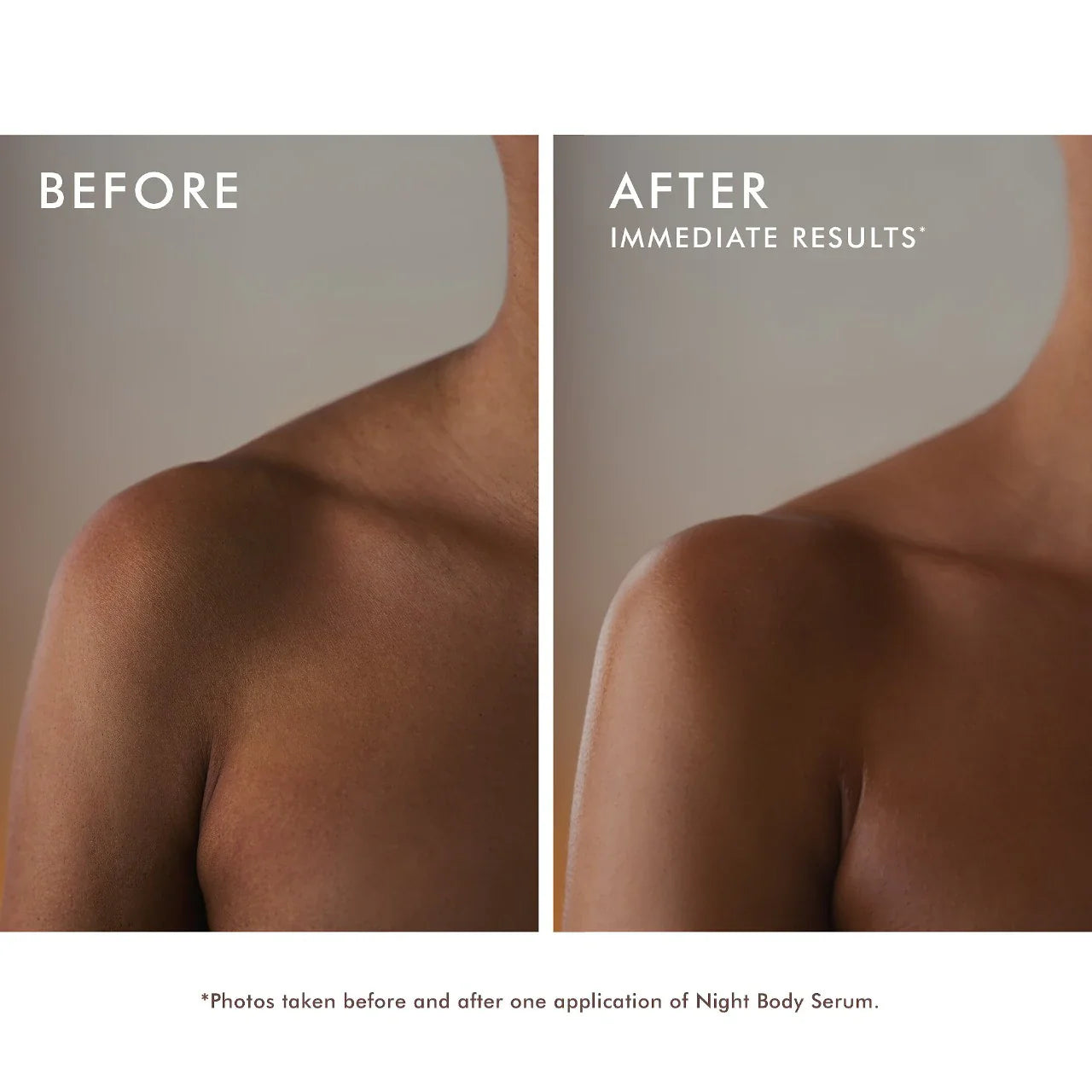 Before and After