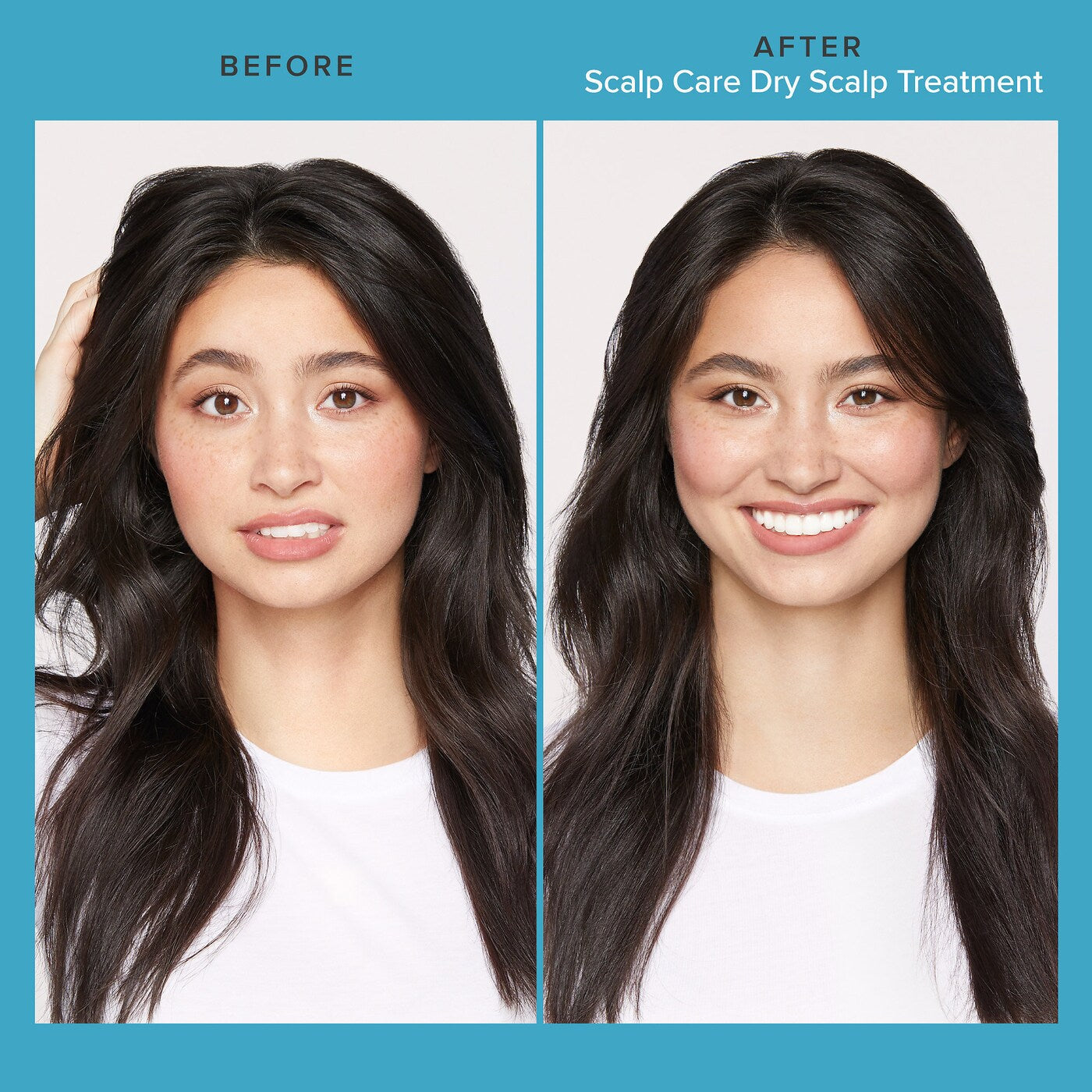 Living Proof Scalp Care Dry Scalp Treatment before and after use