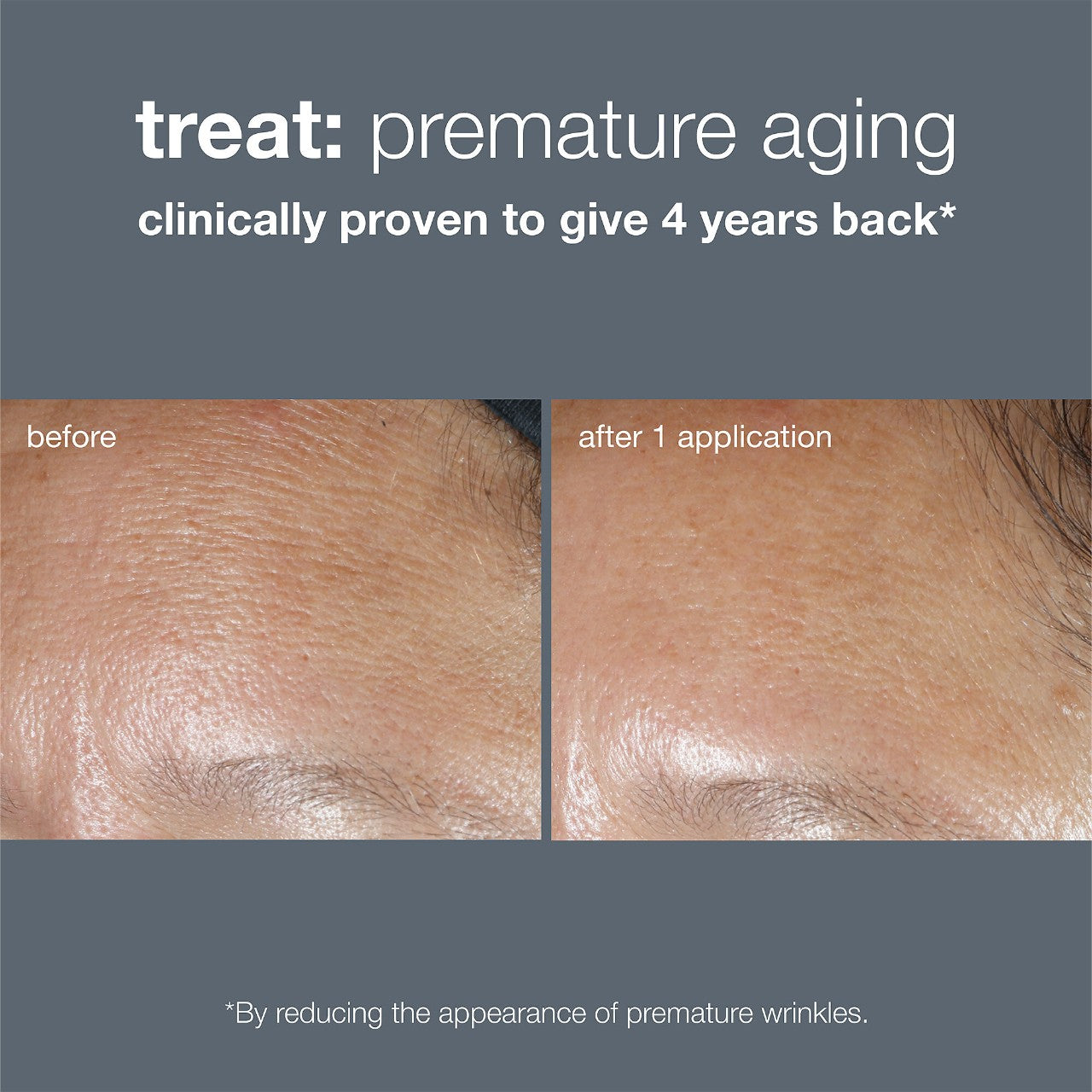 Dermalogica Phyto Nature Oxygen Cream after 1 application prevents premature aging