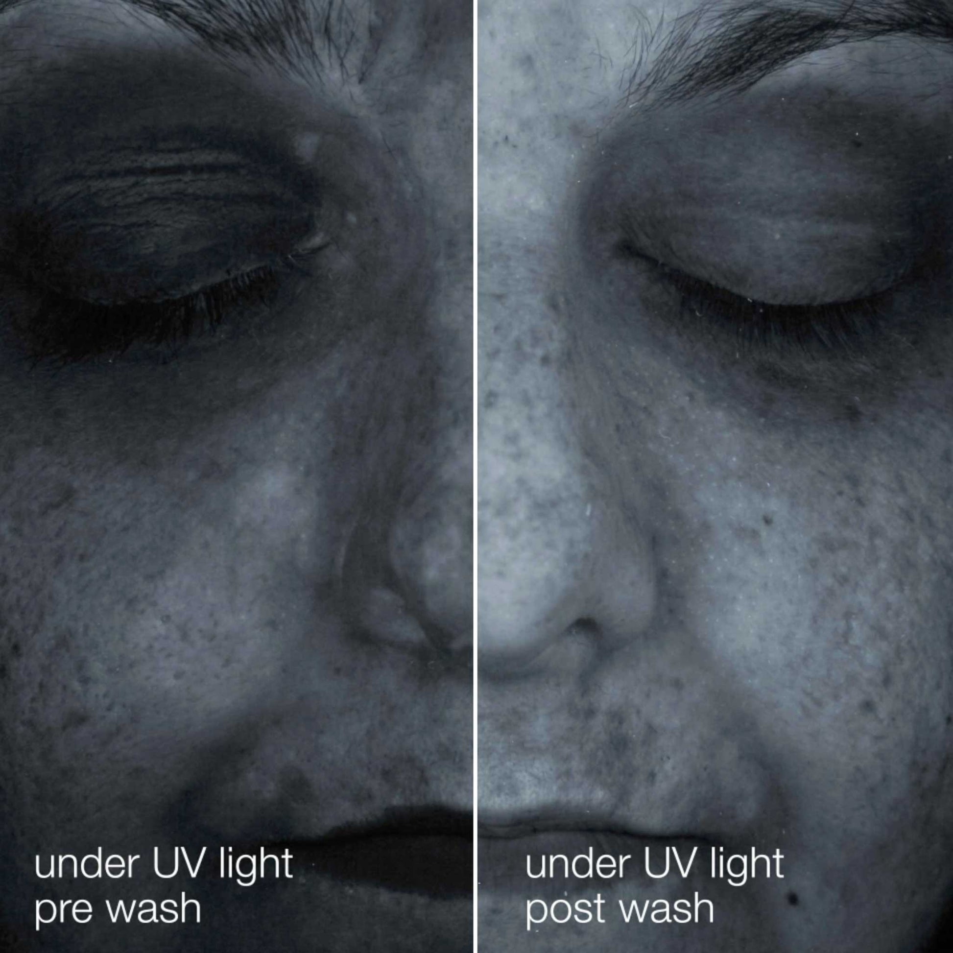 Dermalogica Oil to Foam Total Cleanser before and after use. Under UV light, skin appears to be brighter and clearer.