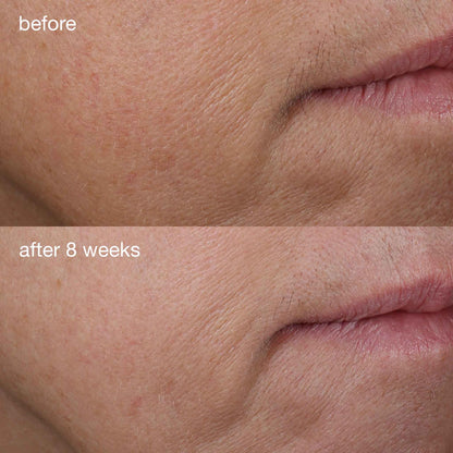 Dermalogica Age Smart Phyto-Nature Firming Serum before and after 8 weeks of use