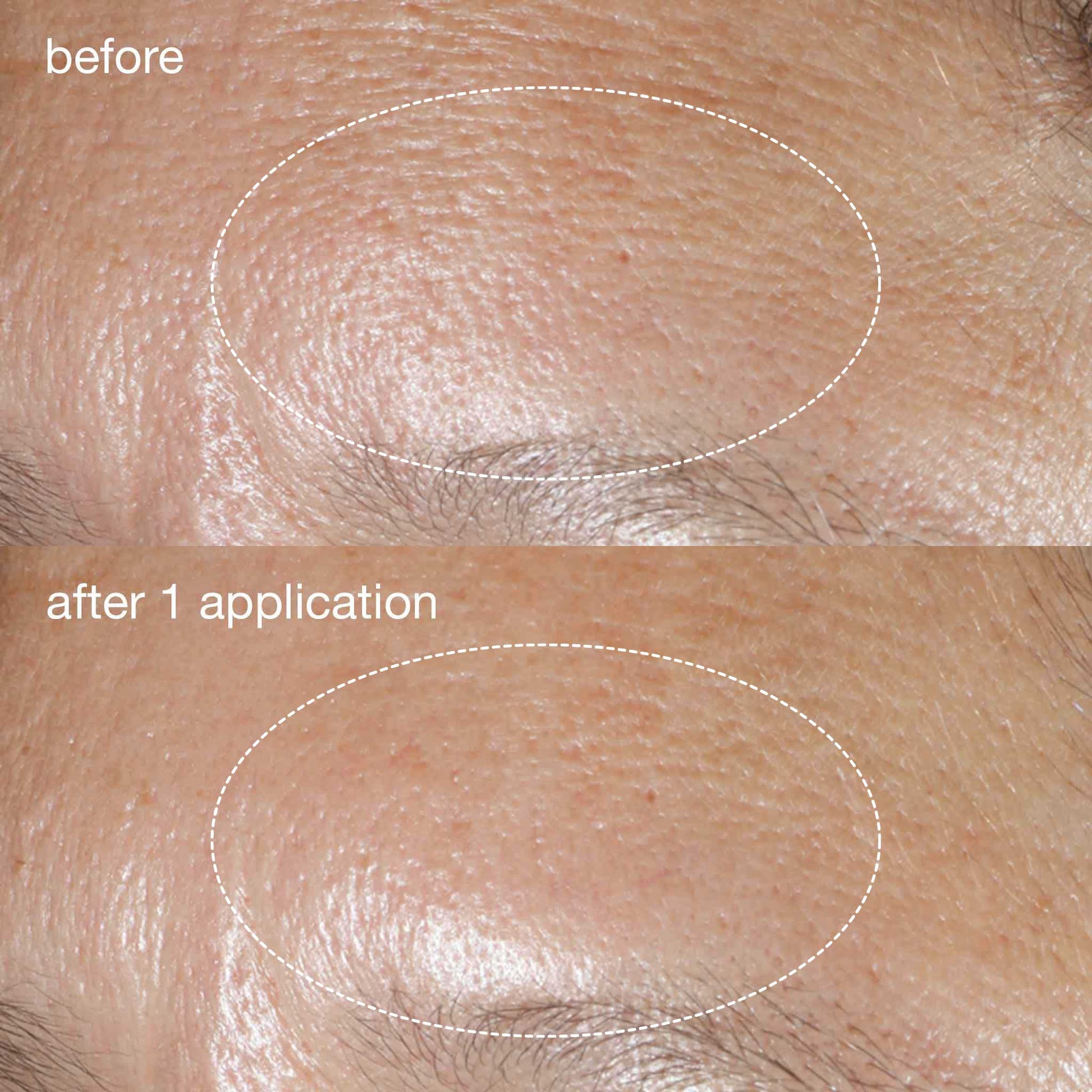 Dermalogica Phyto Nature Oxygen Cream before and after
