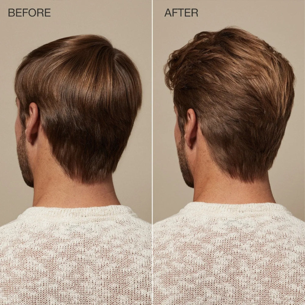 Before and After 