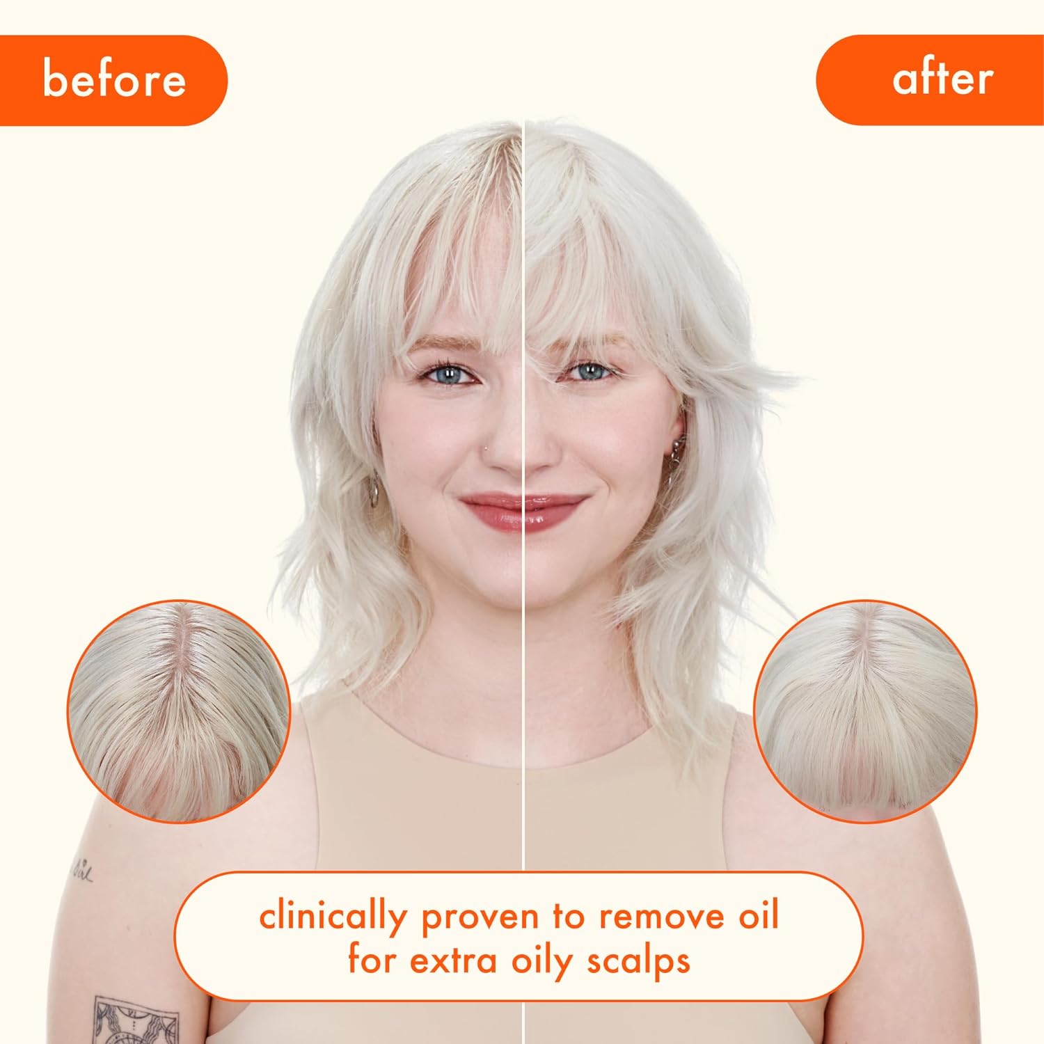 before and after showing less oily hair and scalp. clinically proven to remove oil for extra oily scalps.