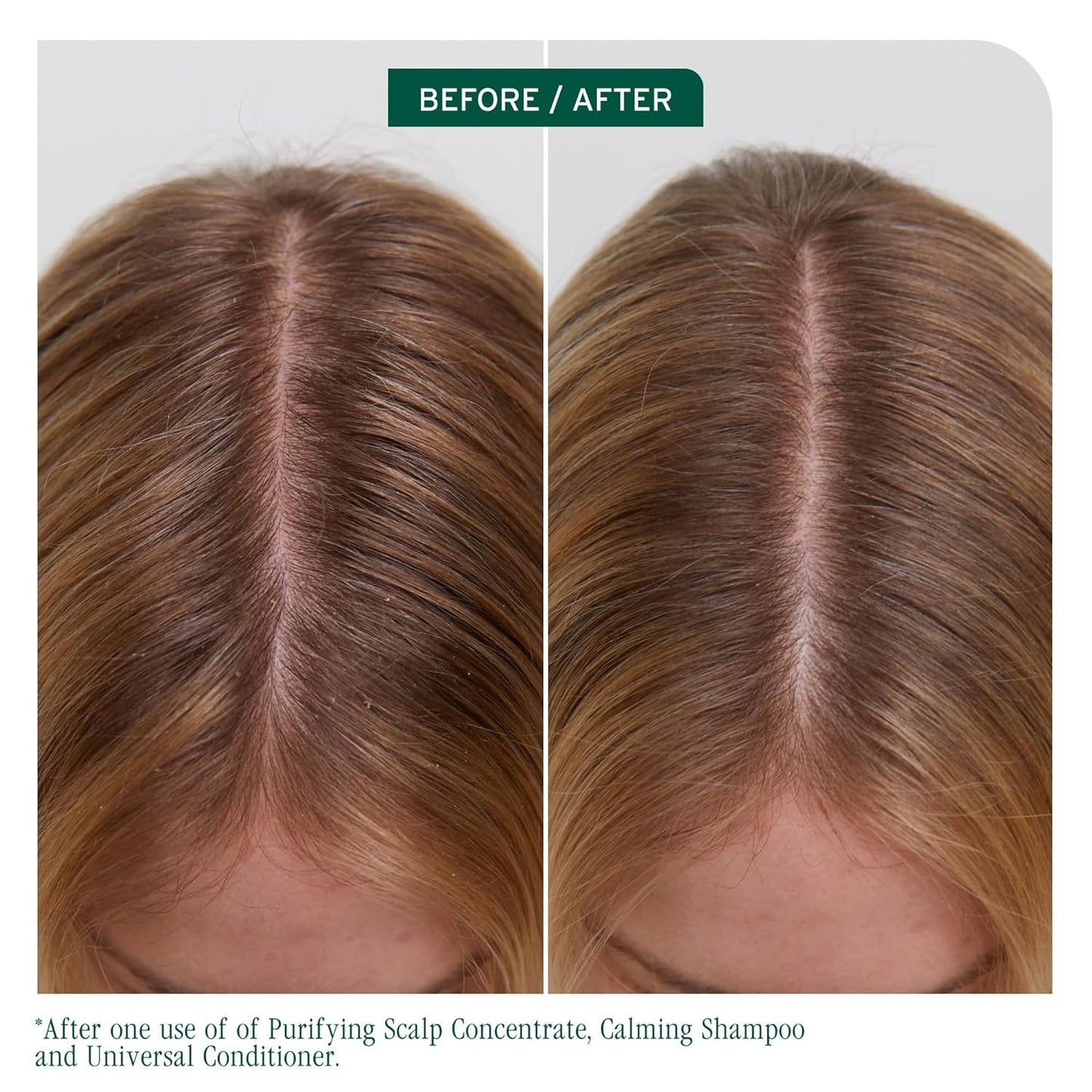Before and after using Biolage Scalp Sync Universal Conditioner
