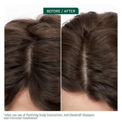 Before and after using Biolage Scalpsync Anti-Dandruff Shampoo