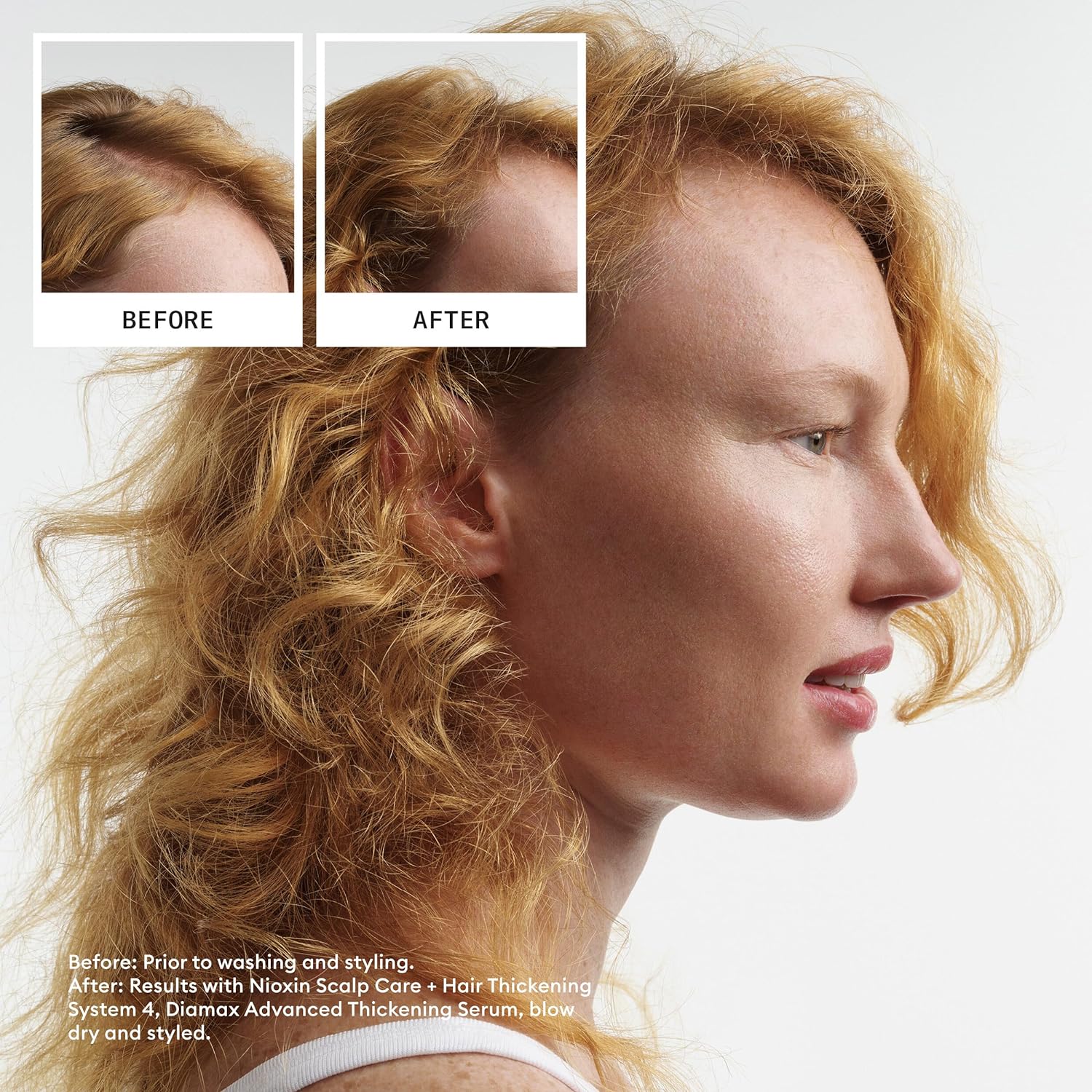 Before and After