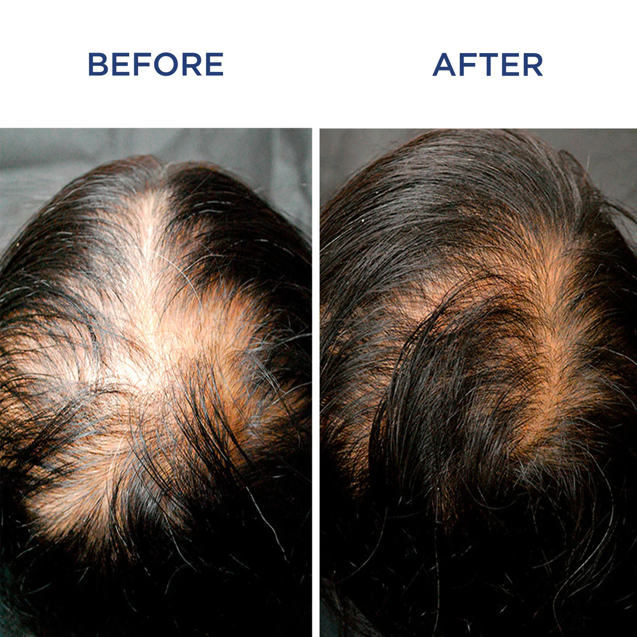 Before and After use results