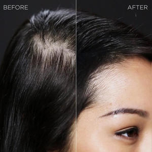 Toppik Hair Building Fibers Before and After