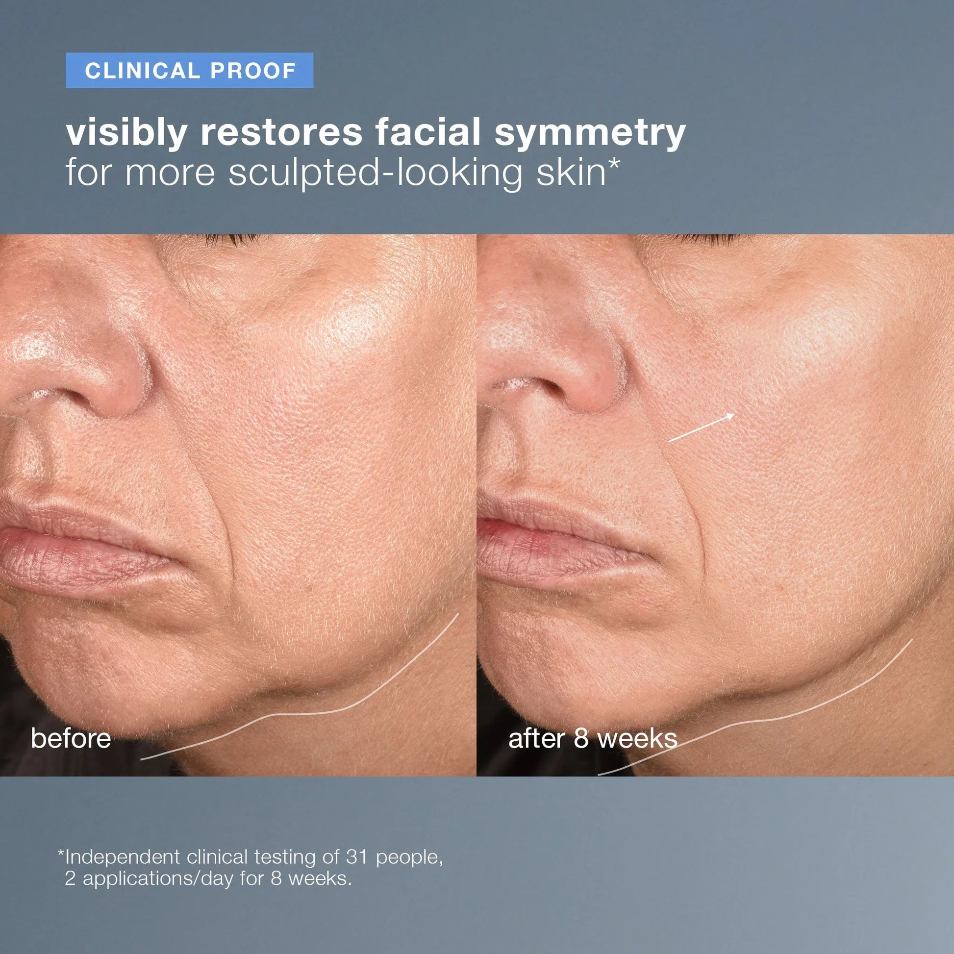 Before and after comparison of facial symmetry with text indicating clinical proof.