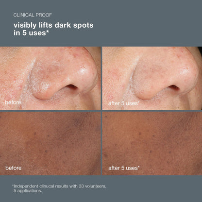 Dermalogica PowerBright Dark Spot Peel