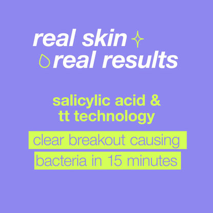 Dermalogica Clear Start Breakout Clearing Booster can clear breakout causing bacteria in 15 minutes