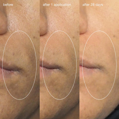 Dermalogica Liquid Peelfoliant after 28 days of use