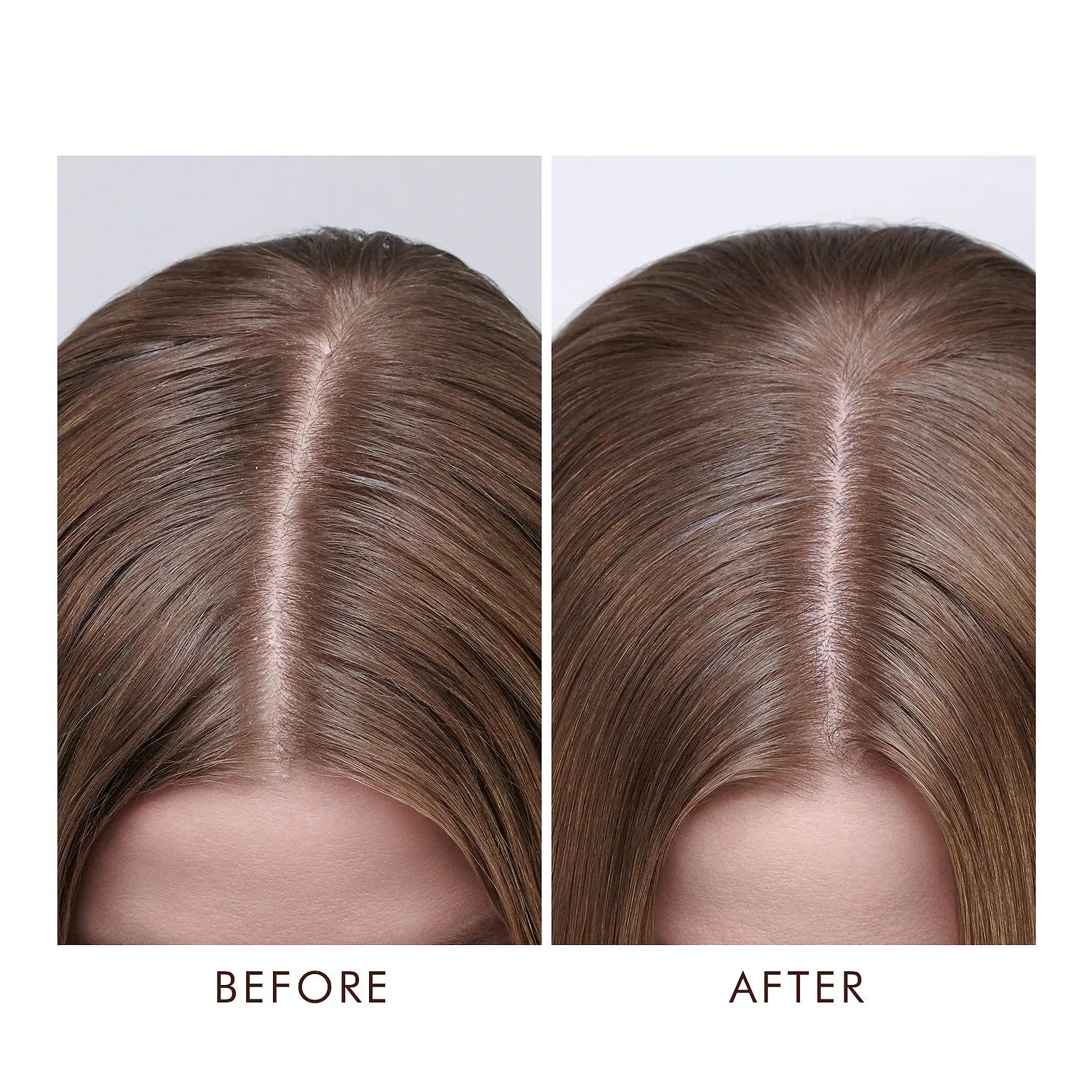 Before and After