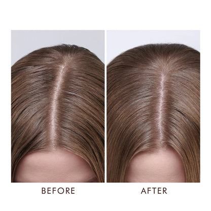 Before and After